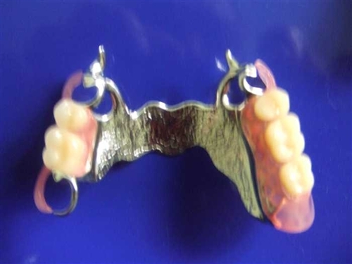 De prothesiste dentaire